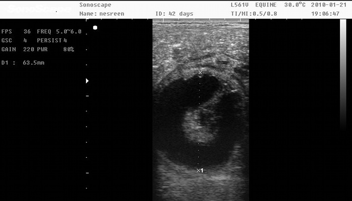 Gynecologic ultrasound